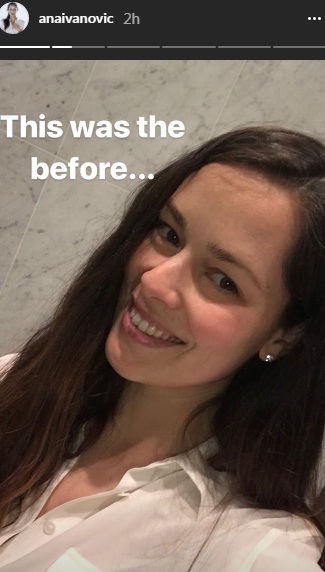 PRONAĐITE RAZLIKU: Ana Ivanović objavila fotke pre i posle šminkanja! 1 ana 1