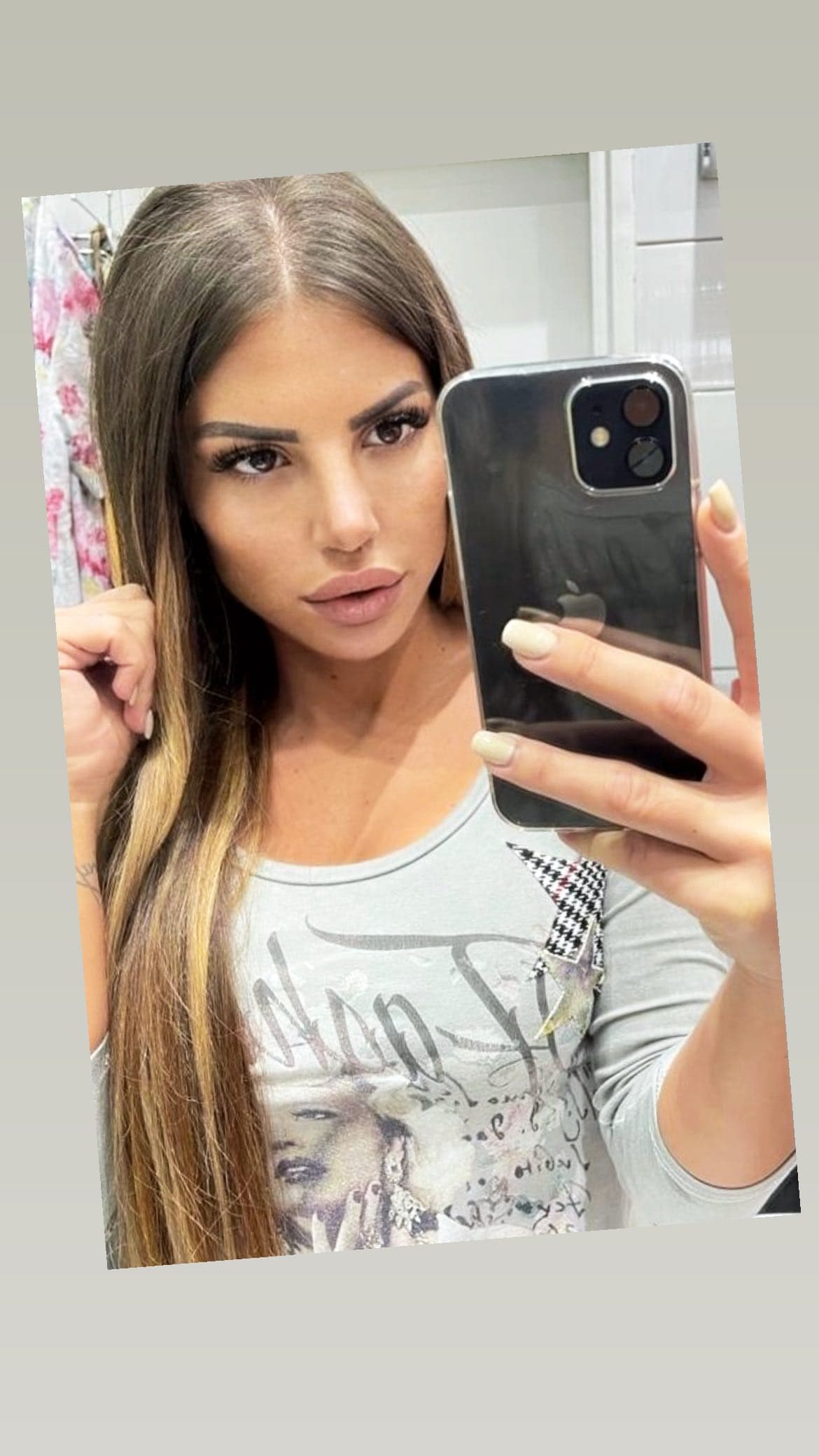 SKINULA ZAVOJE: Dragana Mitar pokazala nos nakon operacije (VIDEO) 1 dragana mitar 1