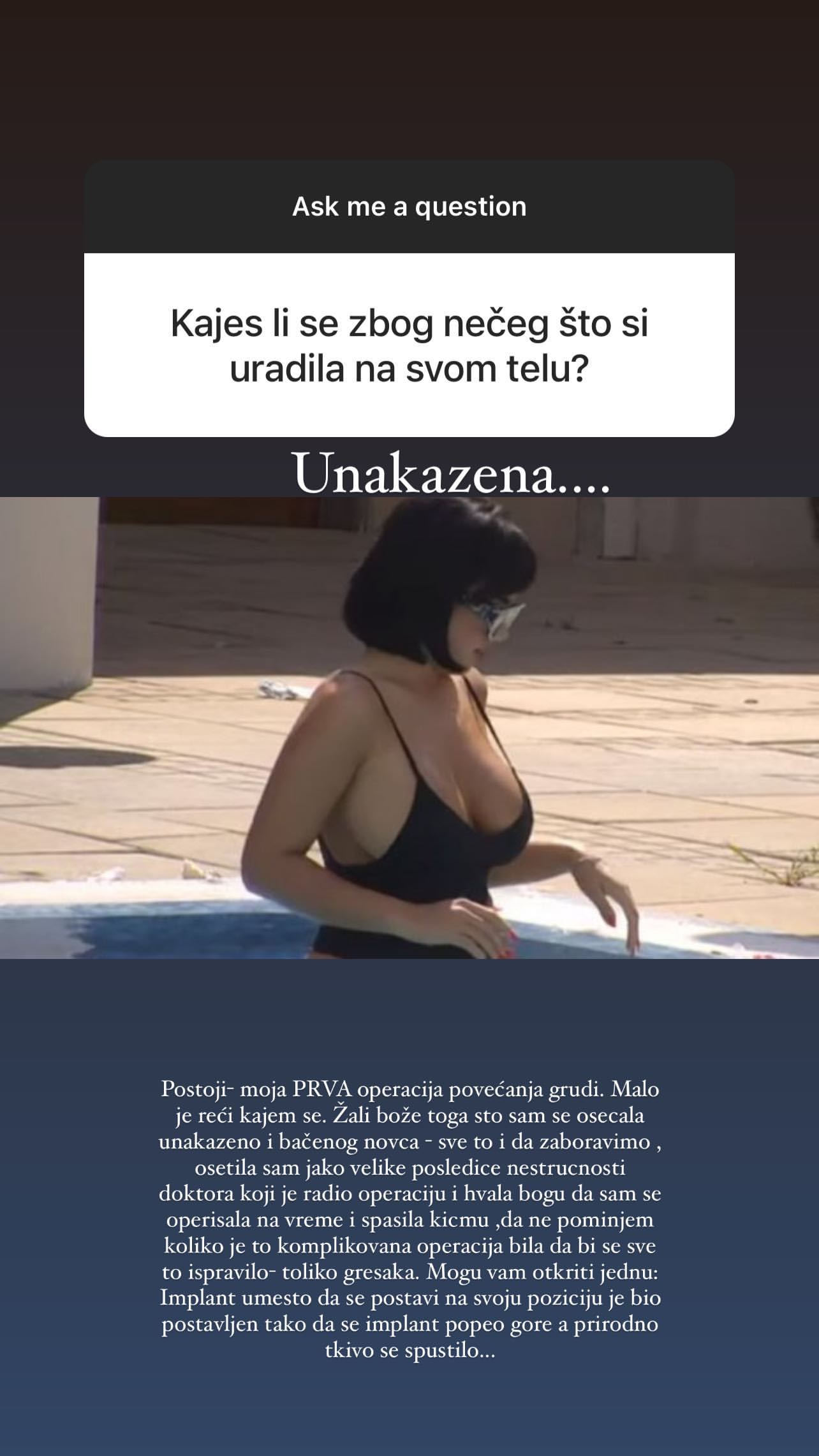 BILA SAM UNAKAŽENA, JEDVA SAM SPASILA KIČMU: Aleksandra Subotić priznala da se kaje zbog prve operacije grudi (FOTO) 1 aleksandra subotic1